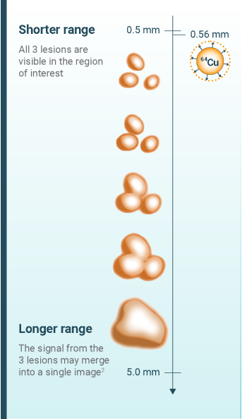 Comparison between a shorter positron range (0.5 mm) showing 3 visible lesions vs a longer positron range (5.0 mm) showing the signal from the 3 lesions merged into a single image.